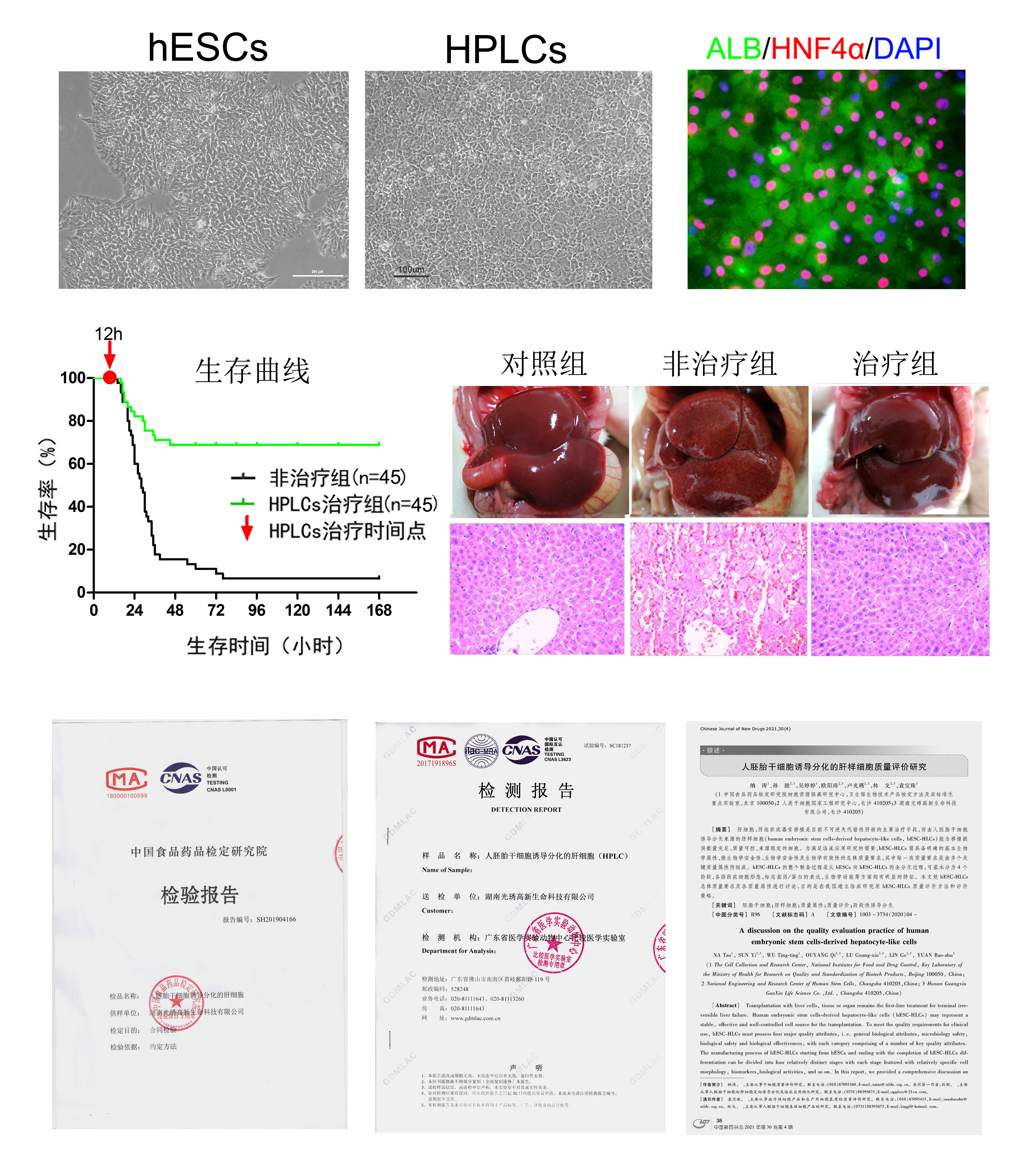 CD19 CAR-T细胞治疗白血病